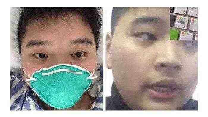 Kesaksian Orang Pertama yang Dapat Sembuh Total dari Virus Corona
