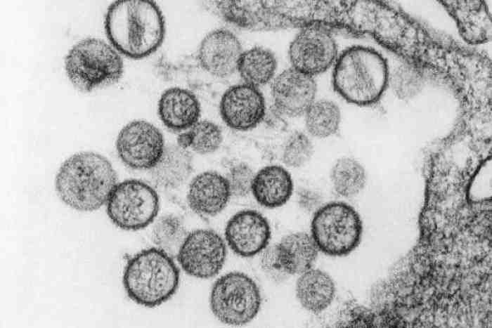 Hantavirus, Tak Dapat Menular Antar Manusia 