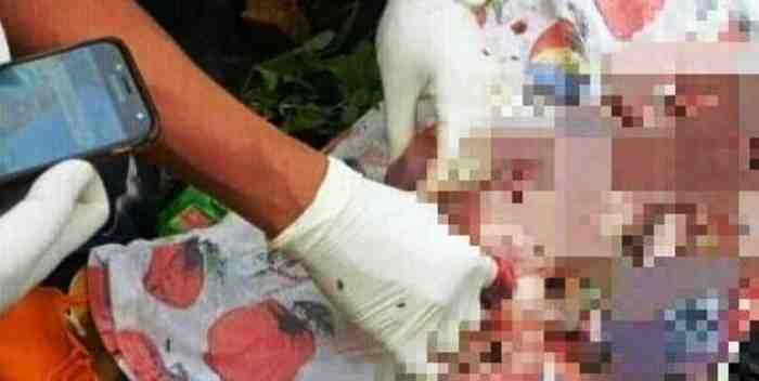 Fakta Klinik Aborsi di Jakpus, Hancurkan 903 Janin dengan Omzet Rp 5,5 Miliar