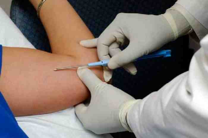 Mengenal Jenis KB dan Efek Sampingnya