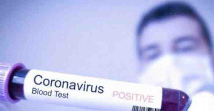 Waspada, ini Hal yang Lebih Berbahaya dari Virus Corona! 