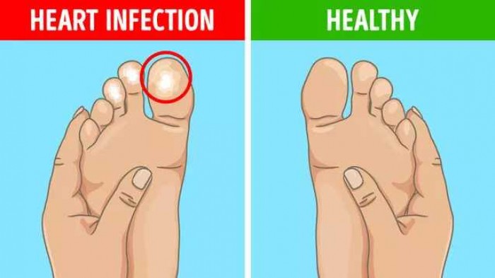 6 Tanda Kaki Bukti Ada Masalah Kesehatan