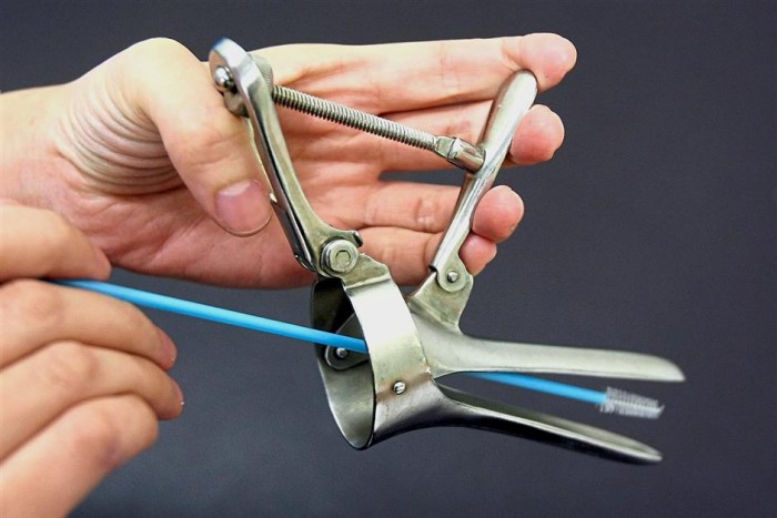 Pap Smear untuk Pencegahan Kanker Serviks Pap Smear untuk Pencegahan Kanker Serviks