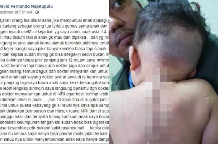 Tulang Sumsum Balita ini Bocor, Akibat Dicium Secara Paksa