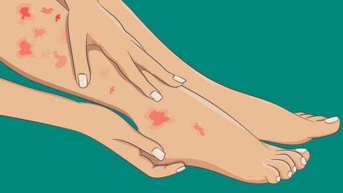 6 Tanda Kaki, Bukti Ada Masalah Kesehatan