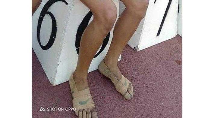 Tak Punya Sepatu, Gadis ini Perban Kakinya untuk Ikut Lomba Lari