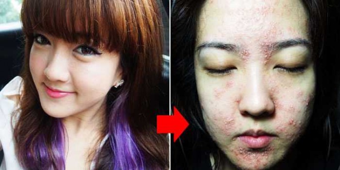 6 Efek Mengerikan Pakai Skincare Palsu, Bukan Cantik Malah Bikin Jijik