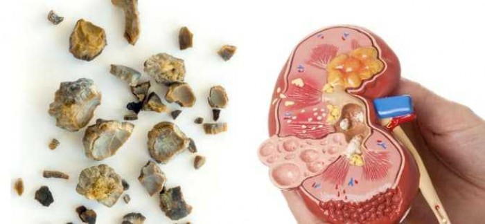10 Manfaat Daun Tin Untuk Tubuh dan Kecantikan