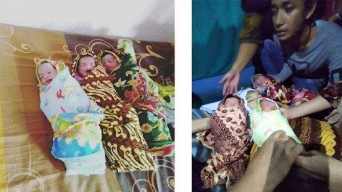 Lahirkan 3 Bayi Kembar, Ibu di Sumatera Langsung Meninggal Dunia