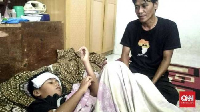 Timbul Korban, Bocah di Depok Dipatuk Anak Kobra Lemas Tak Bersuara 