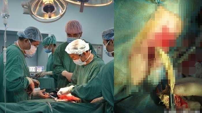 Dokter Kandungan: ‘Melahirkan normal pasca caesar itu berisiko tinggi!’