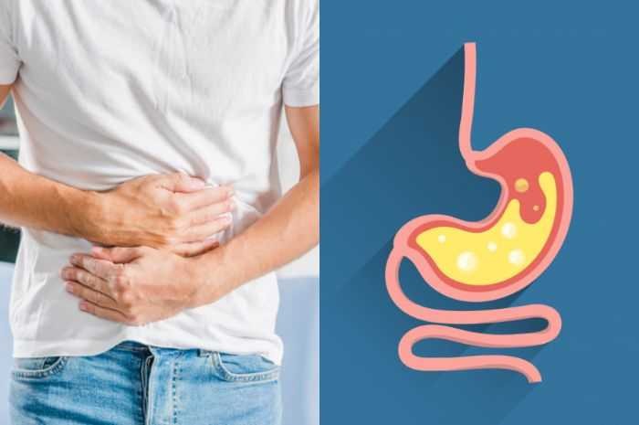 Cara Mengatasi Asam Lambung yang Naik dengan Bahan Alami Cara Mengatasi Asam Lambung yang Naik dengan Bahan Alami