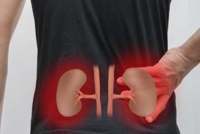 Gejala Sakit Ginjal Ini Perlu Anda Kenali Gejala Sakit Ginjal Ini Perlu Anda Kenali