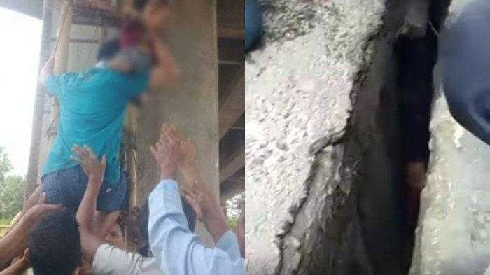 Jatuh Saat Diboncengan Ibu, Balita ini Terjepit Dalam Lubang yang Sempit
