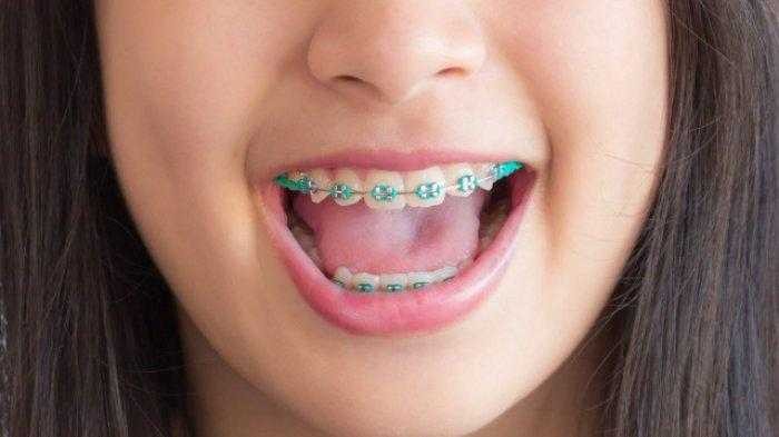 8 Penyebab Gusi Bengkak dan Cara Mengobatinya