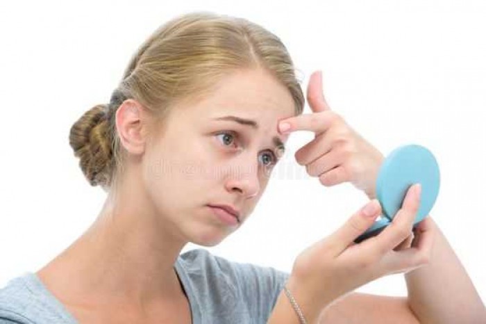7 Tips Ampuh Mengatasi Kulit Wajah Kering, Iritasi, Berjerawat, dan Sensitif