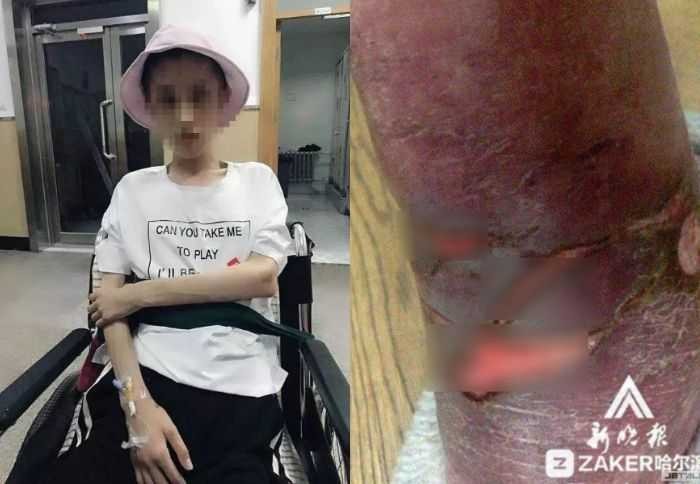 Koma 40 Hari dan Otaknya Rusak, Karena Diet