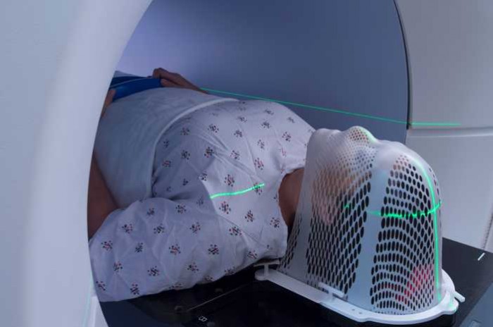 Tumor Otak: Gejala, Penyebab, dan Pengobatannya