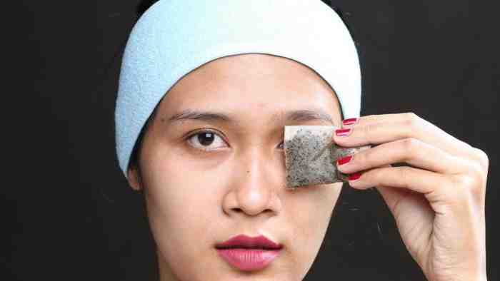 10 Cara Menghilangkan Kantung Mata Secara Alami