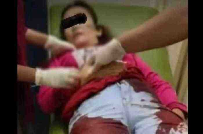 Begal Sadis Bubuh Ibu Rumah Tangga Hingga Bersimbah Darah di Lampung