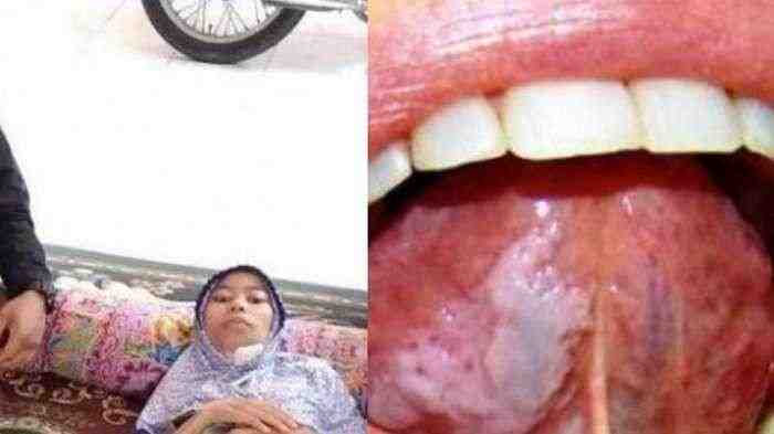 Banyak Dijajakan di Pasar, Ternyata Tahu Bulat Bisa Sebabkan Kanker