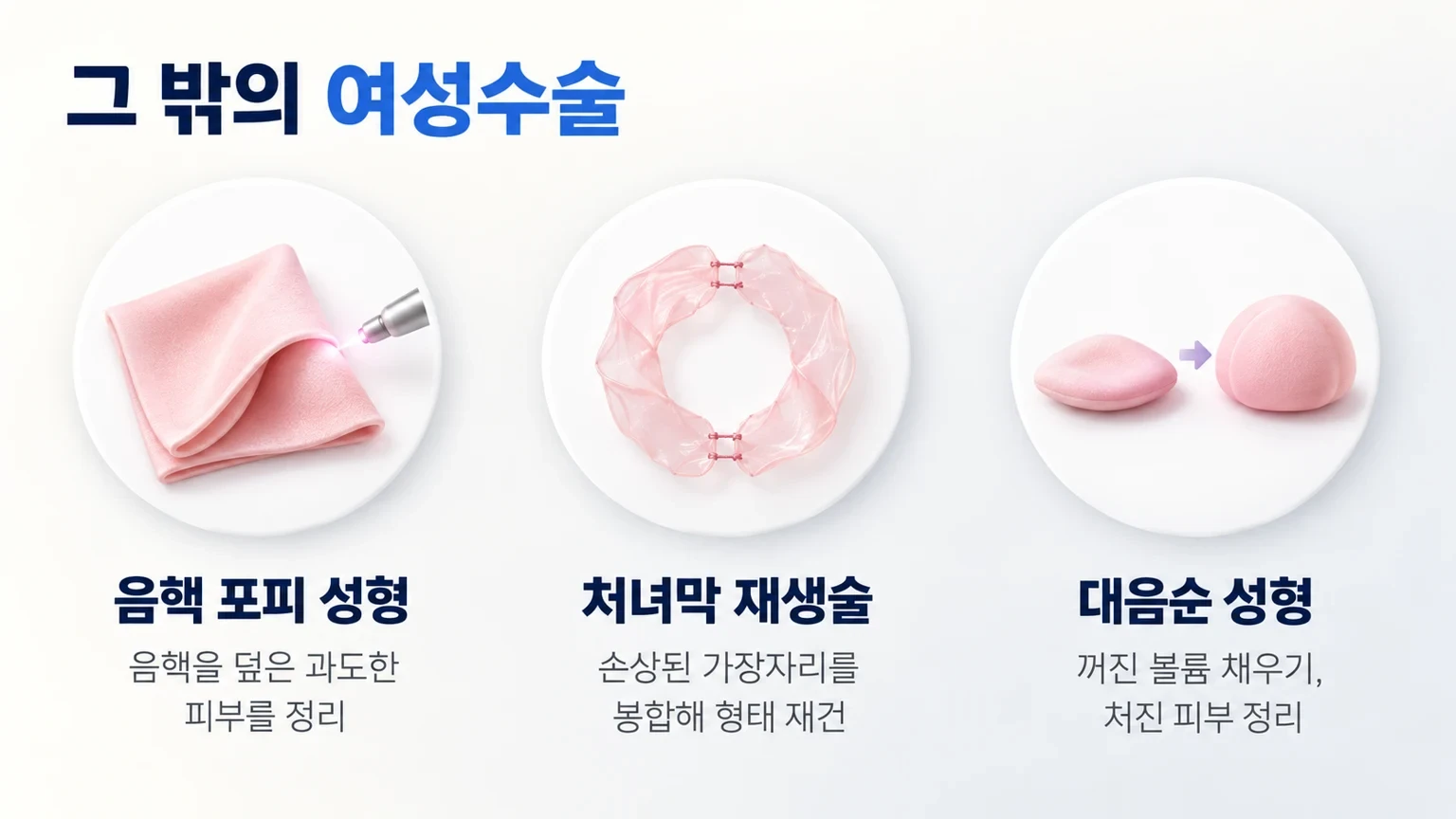 음핵 포피 성형, 처녀막 재생술, 대음순 성형의 교정 부위와 목적을 나눈 카드 이미지