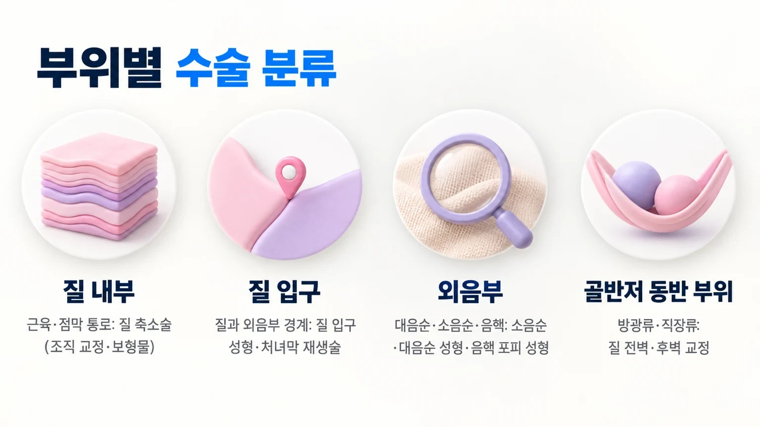 질 내부, 질 입구, 외음부, 골반저 동반 부위로 여성수술 종류를 나눈 부위별 분류 카드 이미지