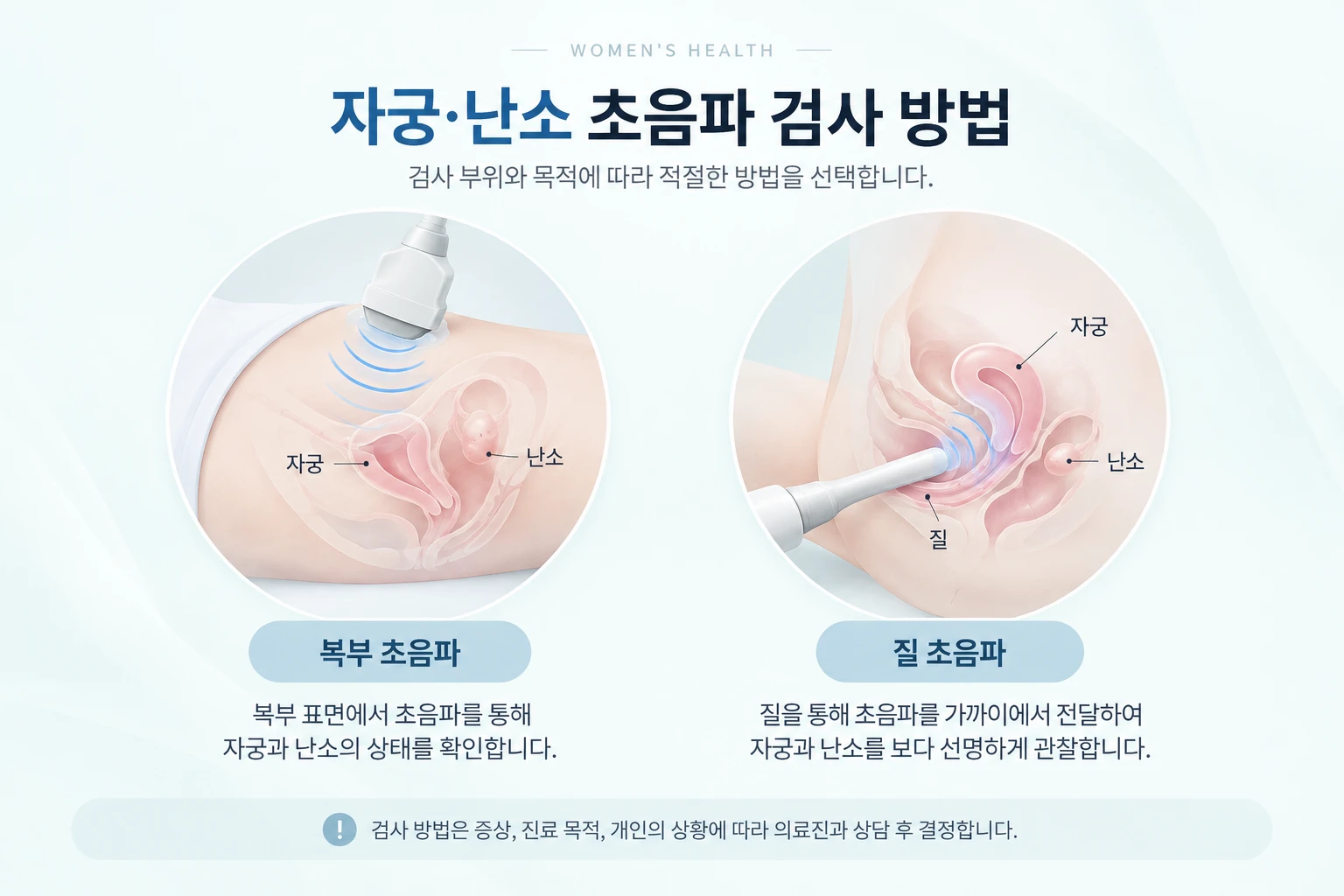 복부용 곡면 탐촉자와 질 초음파용 긴 탐촉자를 같은 조건에서 비교한 초음파 검사 장비 사진