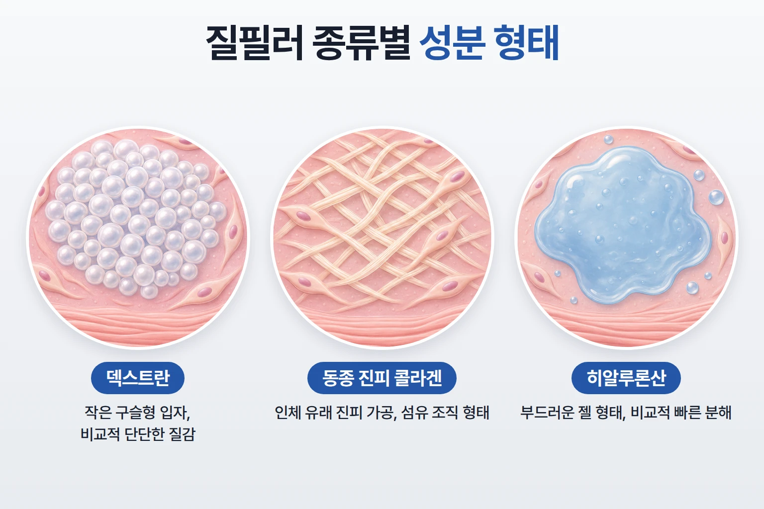 덱스트란 입자, 동종 진피 콜라겐 섬유, 히알루론산 젤의 형태를 같은 배율로 비교한 확대 일러스트
