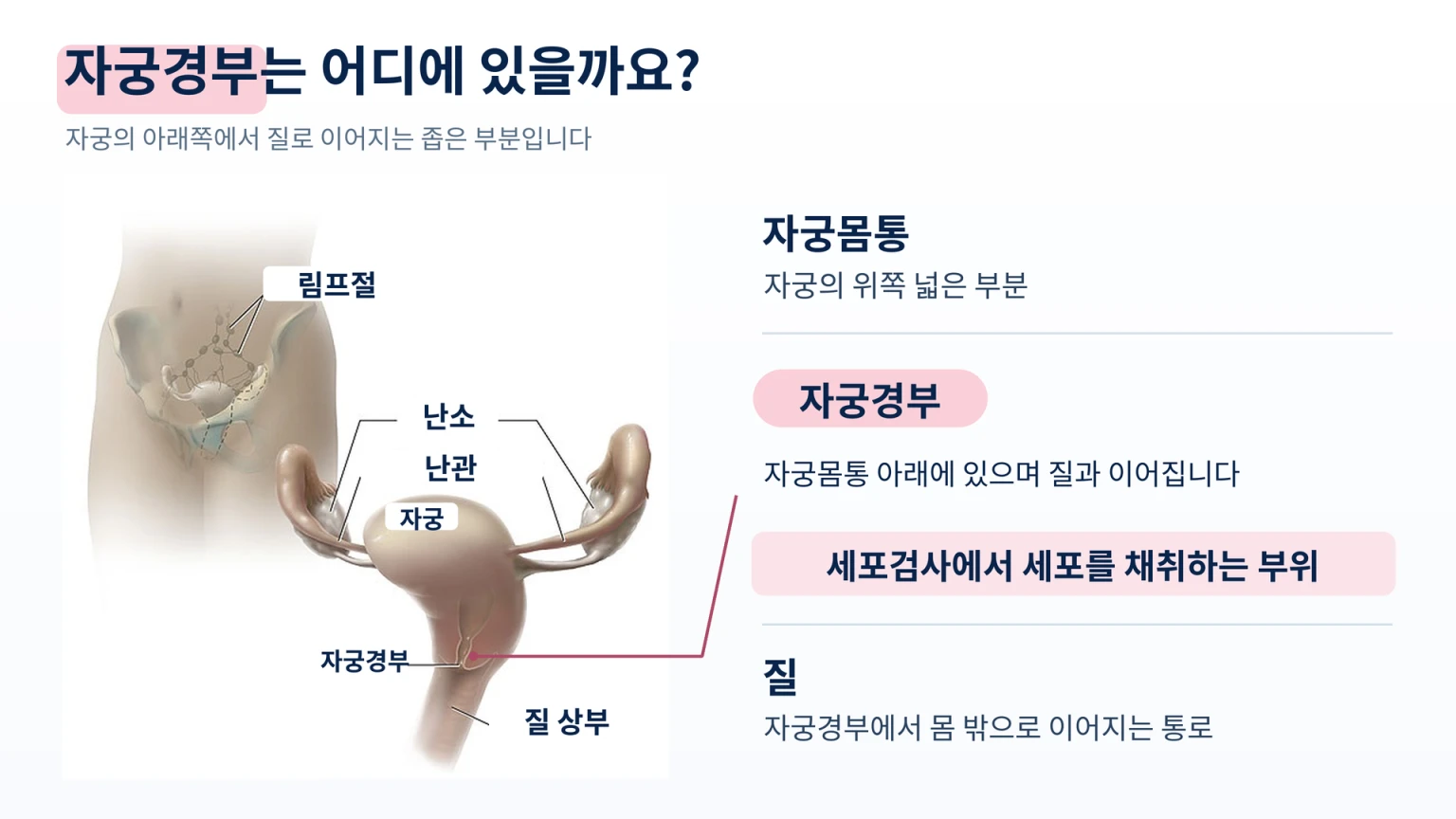 자궁몸통과 질 사이에 위치한 자궁경부와 세포 채취 부위 안내도
