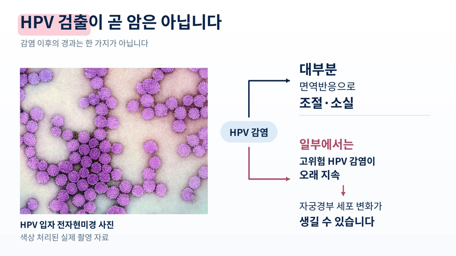색상 처리된 HPV 입자의 전자현미경 사진과 감염 소실 및 고위험 HPV 지속 감염의 경과
