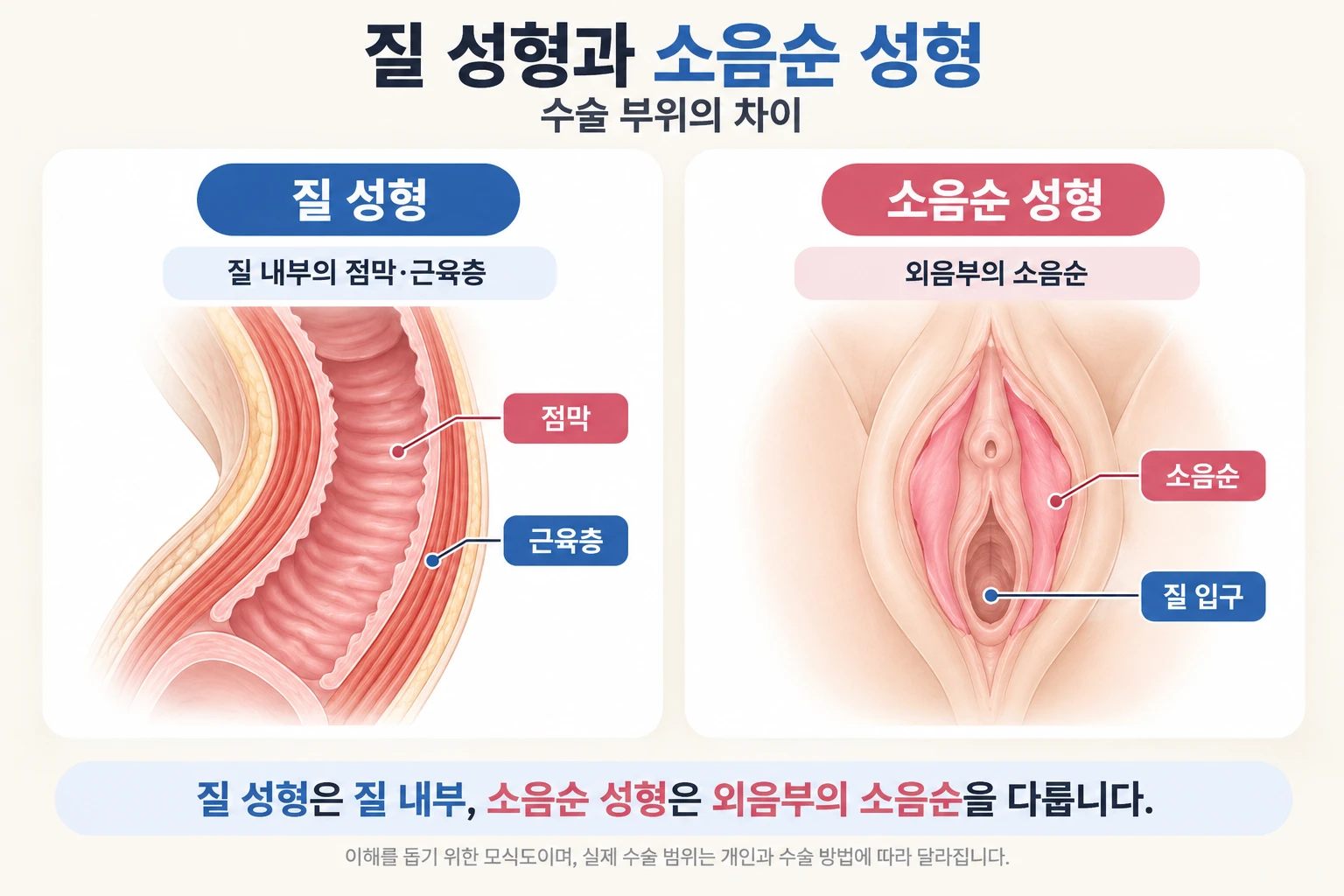밝은 수술실에 놓인 멸균 기구 트레이와 무영등, 마취 감시 장비를 담은 수술 준비 사진