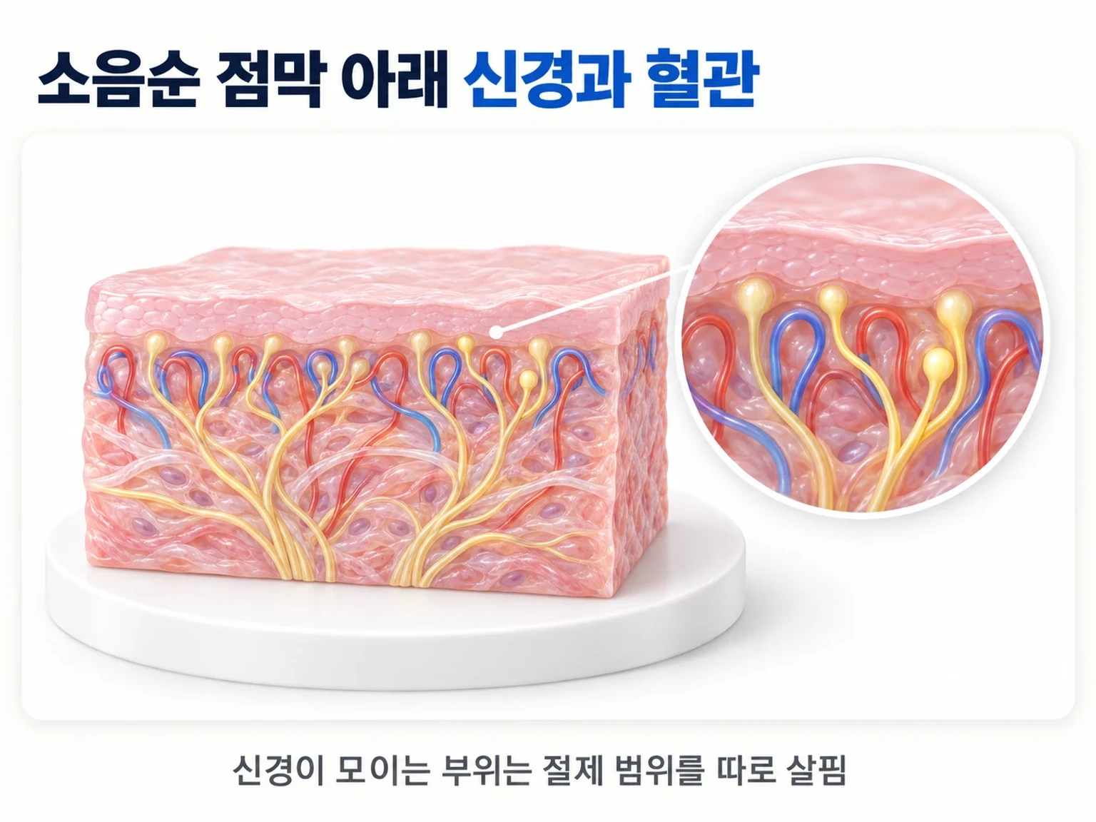 소음순 점막 상피 바로 아래로 가는 신경 가지와 혈관이 퍼져 있는 모습을 확대한 조직 모식도