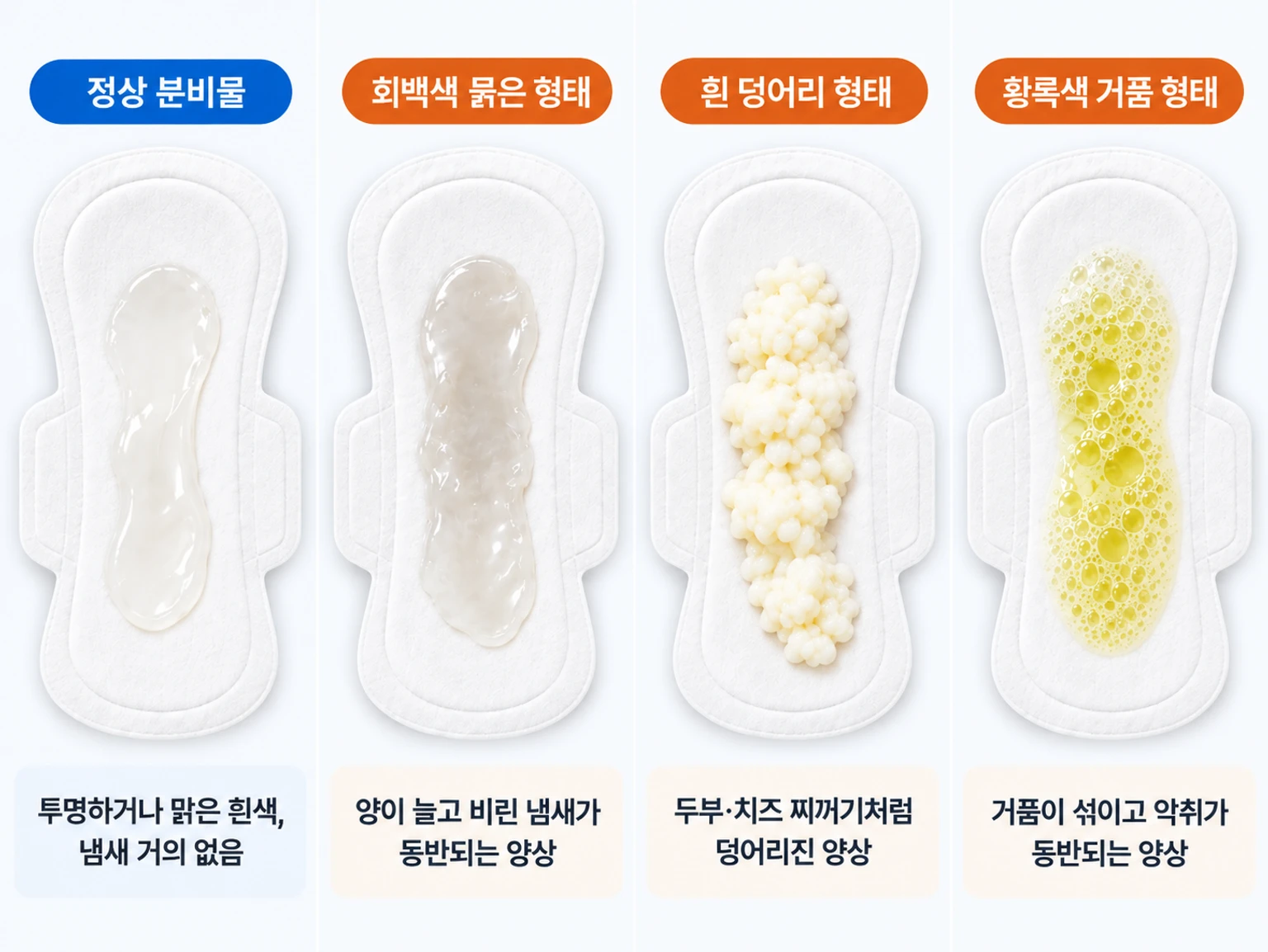 회백색, 흰 덩어리, 황록색 거품 등 질 분비물 색과 형태를 함께 비교한 검체 사진