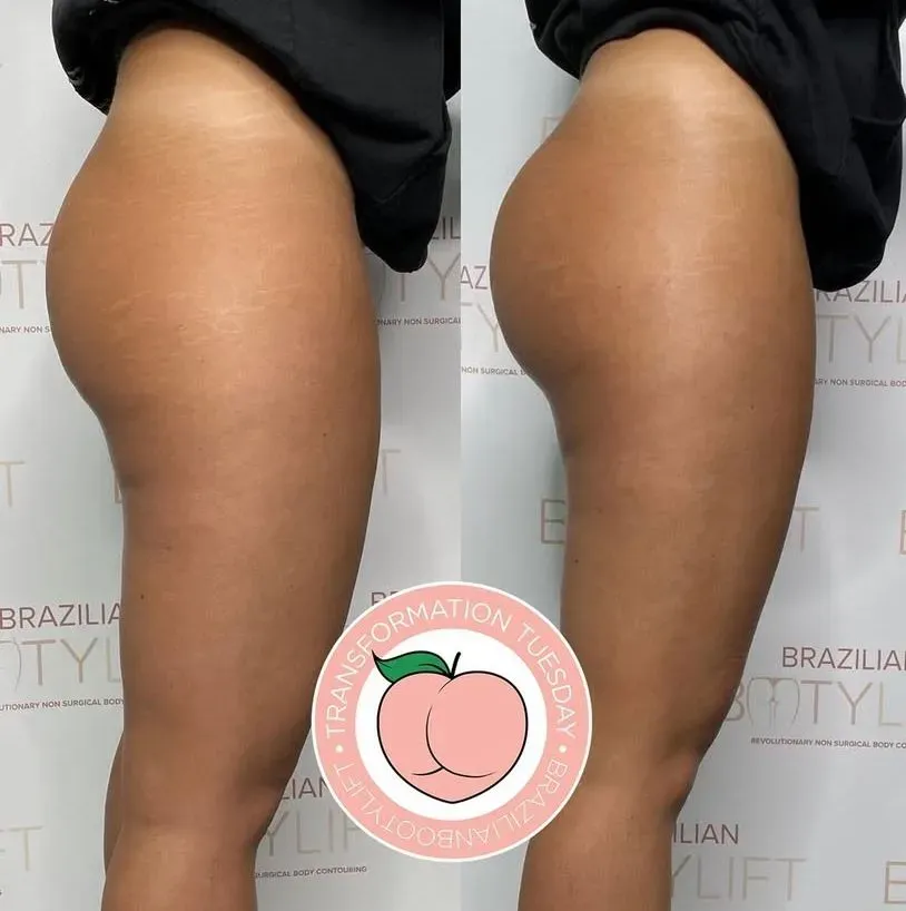Non-Surgical Procedures image