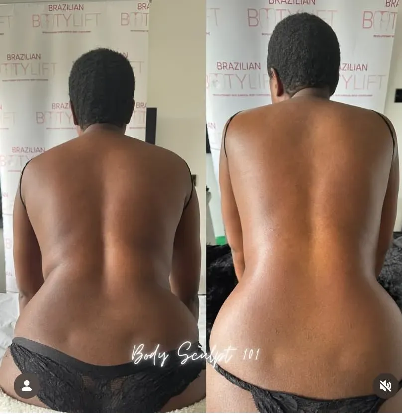 Non-Surgical Procedures image