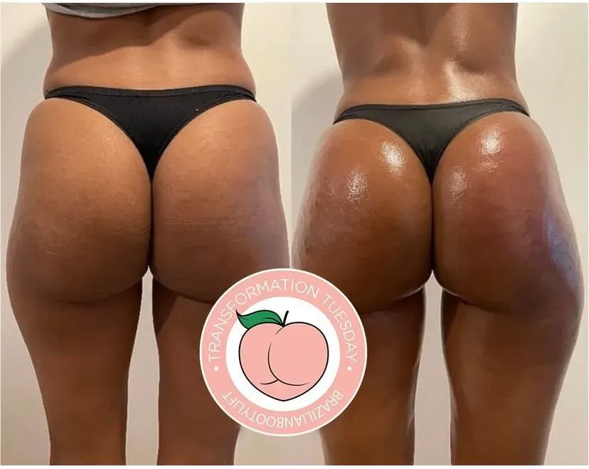 Non-Surgical Procedures image