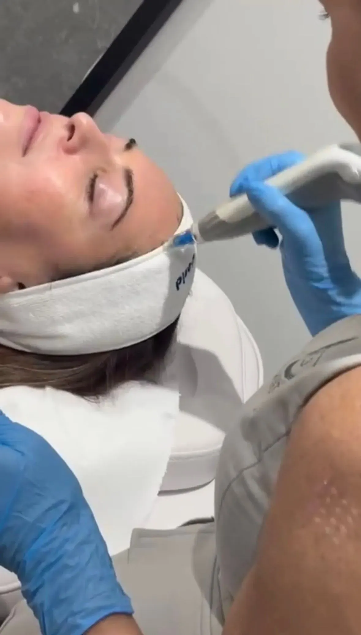 Microneedling image background image