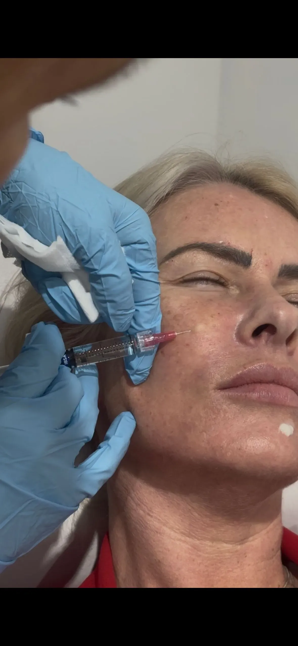 Skin boosters image background image