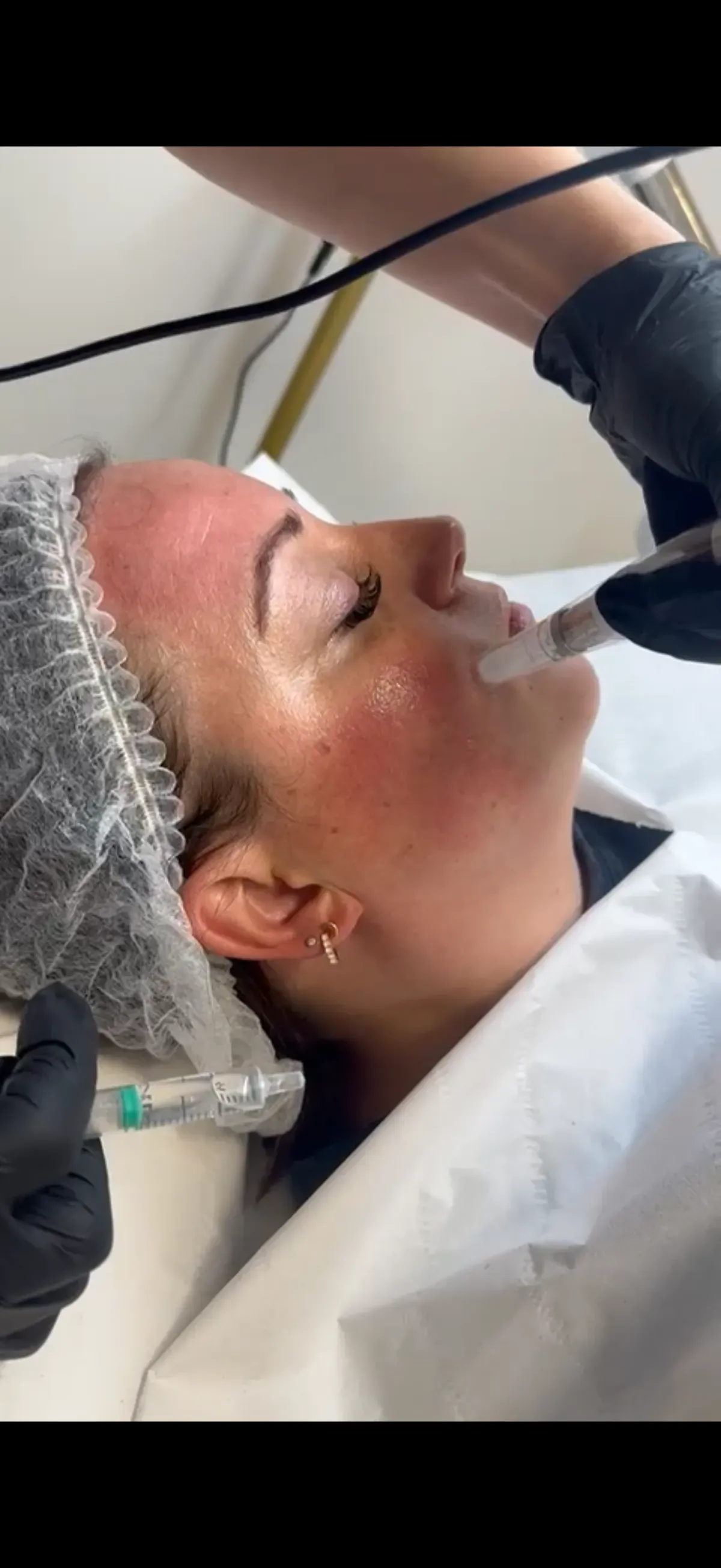 Microneedling image background image