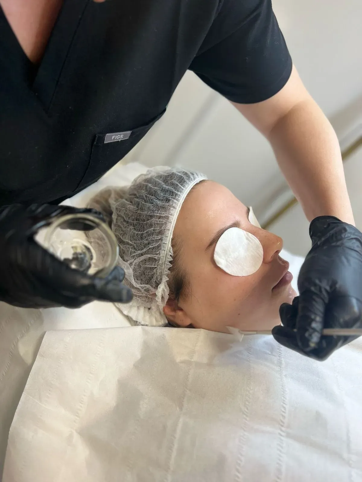Chemical peel image background image