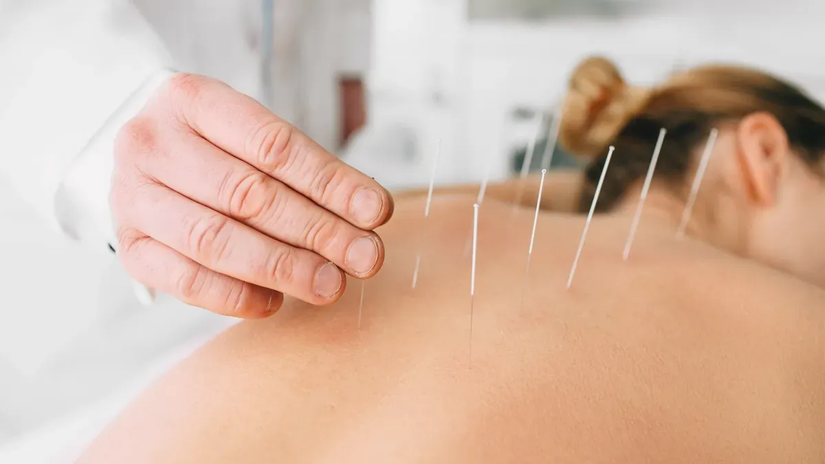 Acupuncture in Rawcliffe