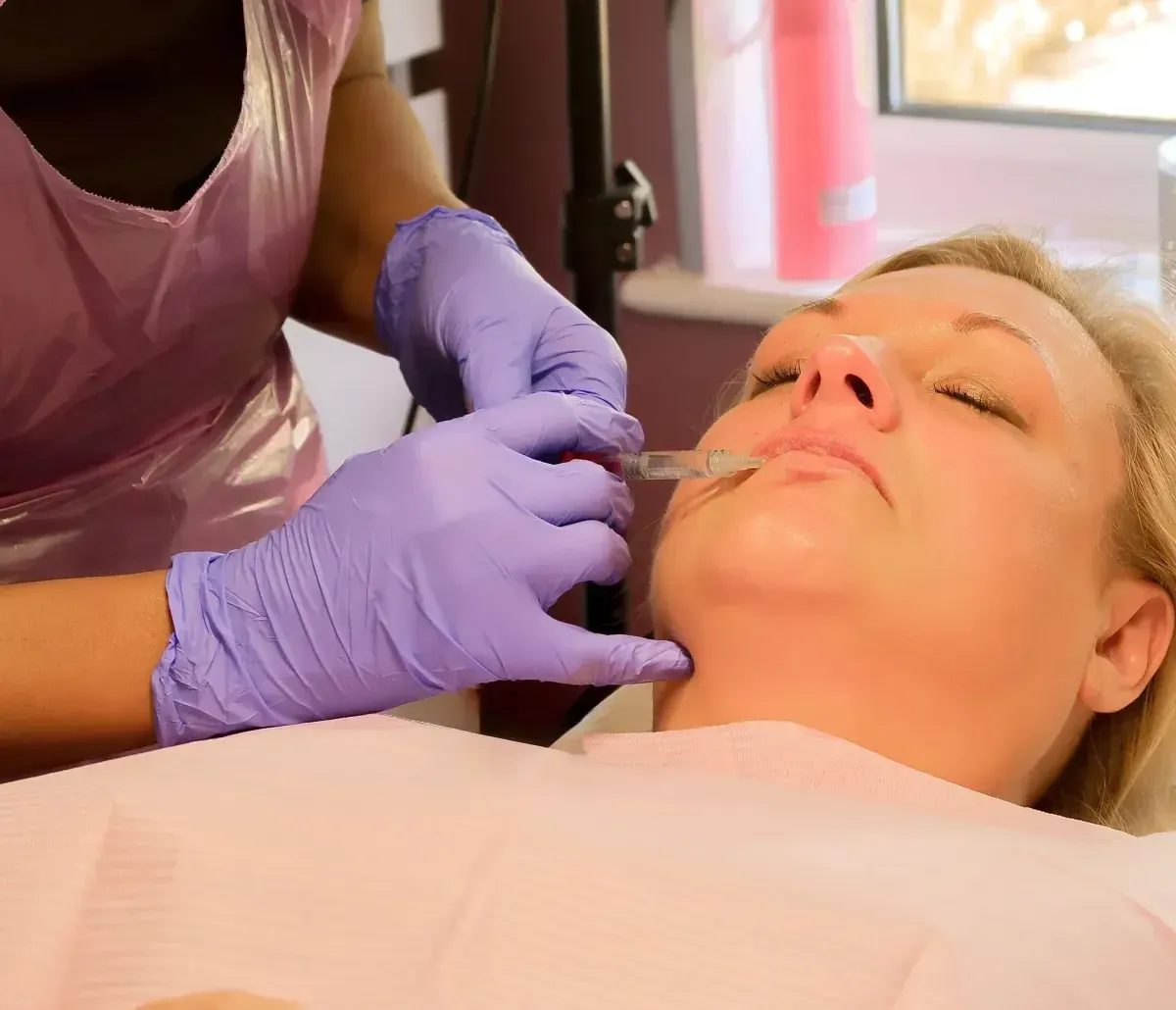 Dermal Fillers