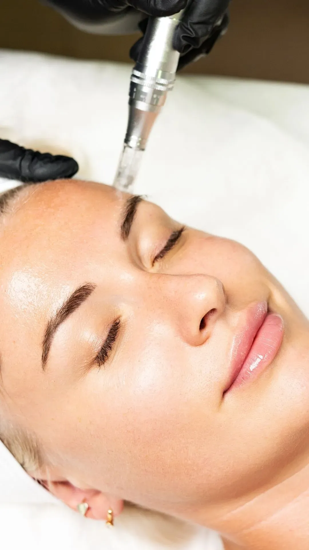 Skin Boosters and Polynucleotides image background image