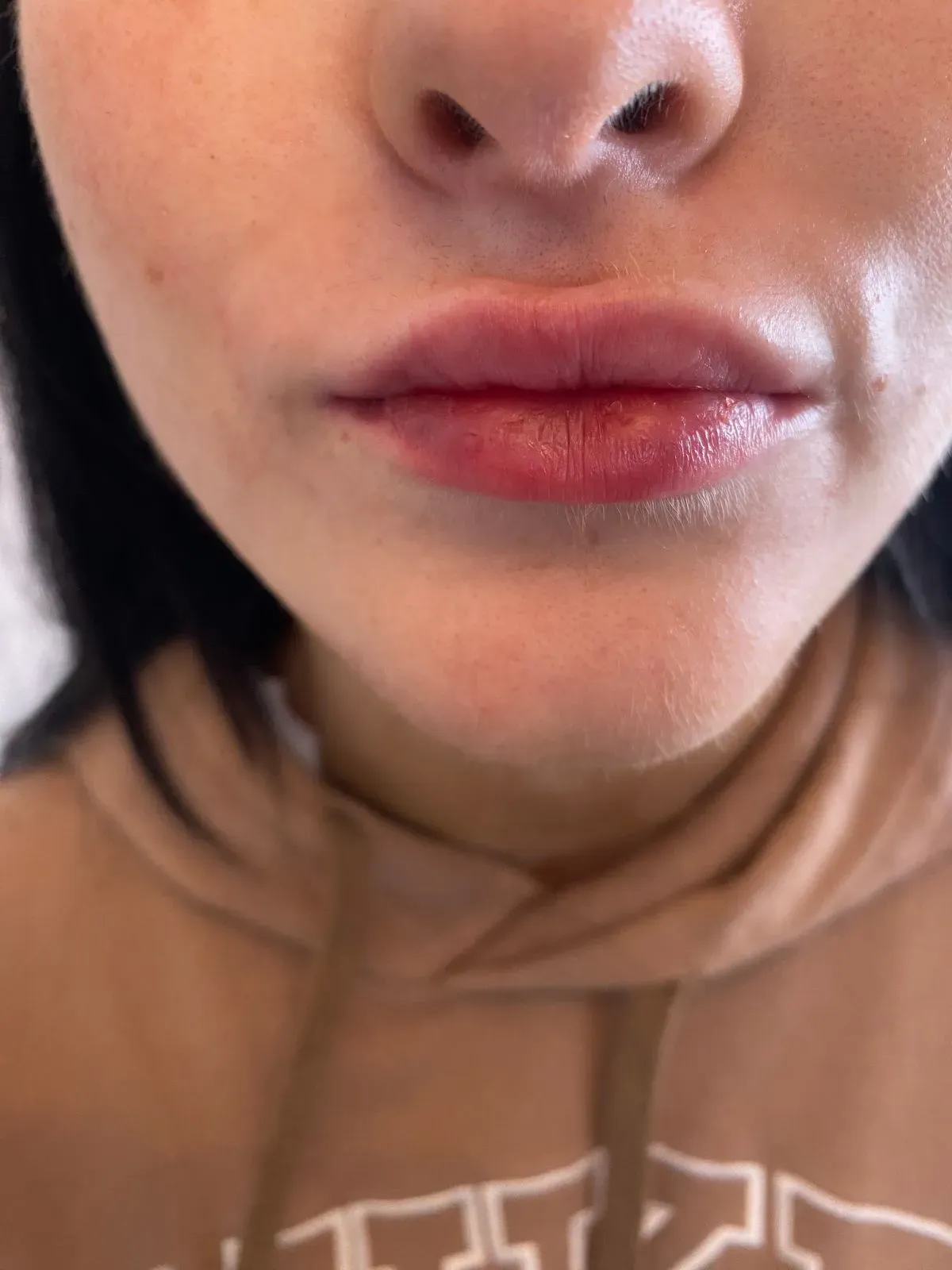 Microneedling image background image