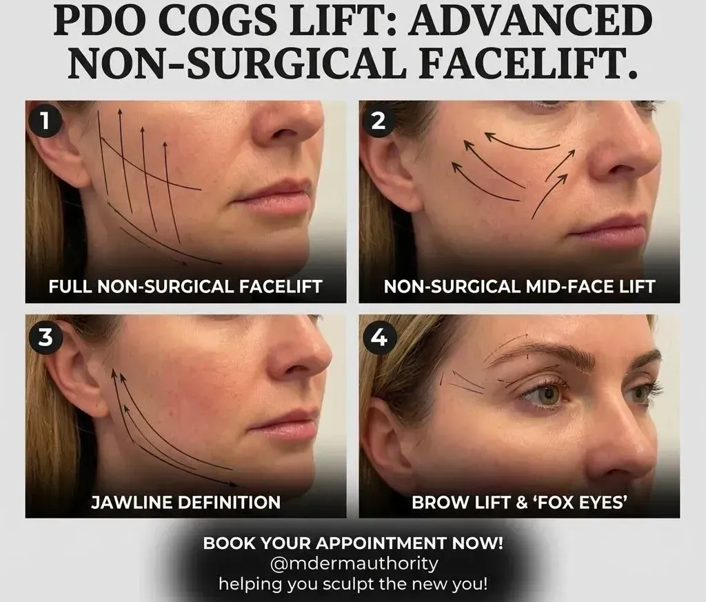 Facial Rejuvenation
