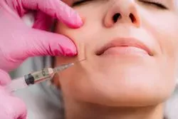 Dermal fillers image