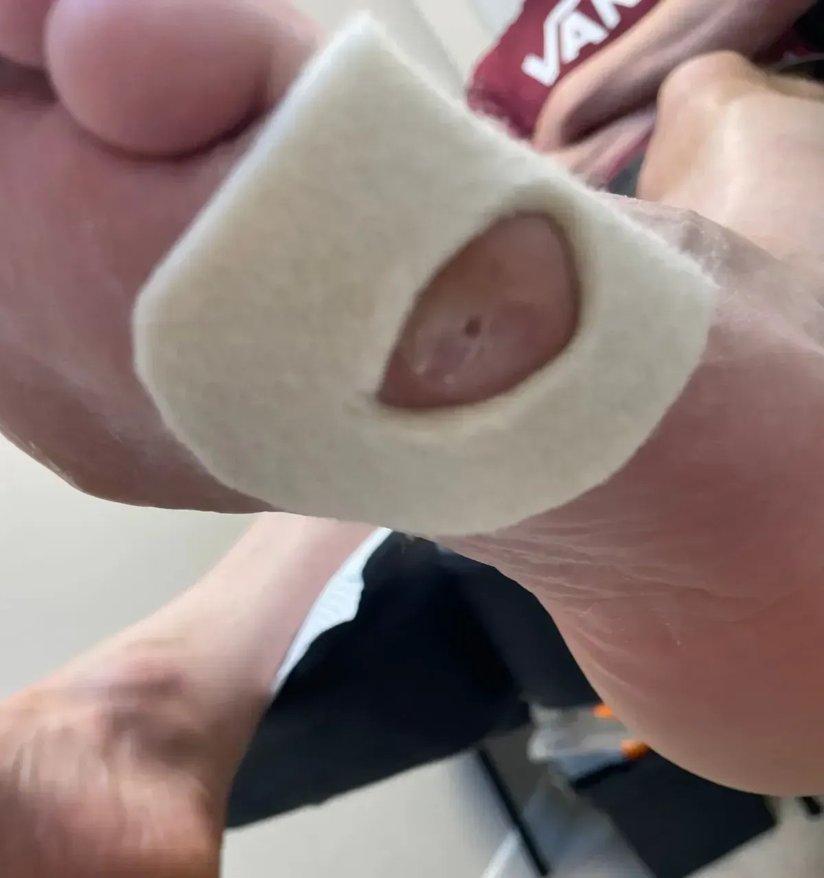 General Foot Assessments