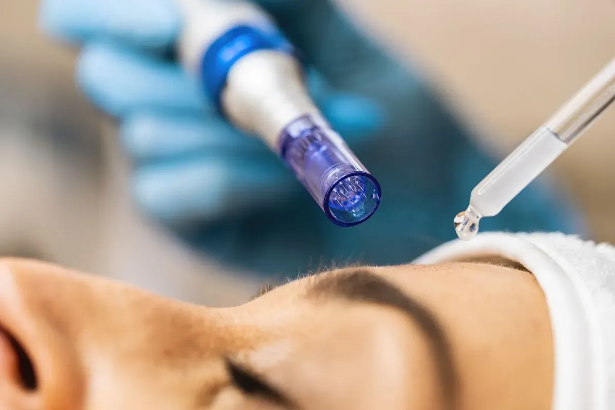 Microdermabrasion image