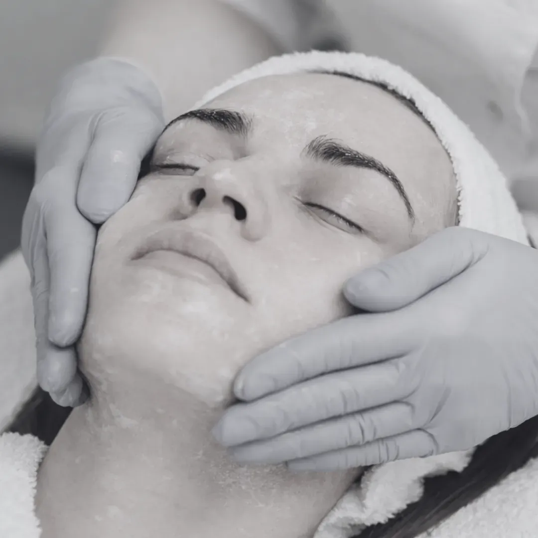 Chemical Peels image
